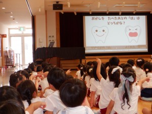 モンダミンキッズ